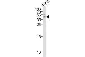 Western Blotting (WB) image for anti-serpin Peptidase Inhibitor, Clade B (Ovalbumin), Member 5 (SERPINB5) antibody (ABIN2996527) (SERPINB5 anticorps)