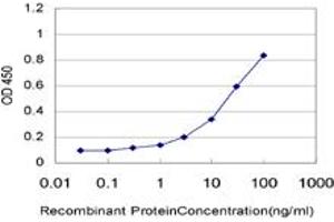 Detection limit for recombinant GST tagged UBE2Q2 is approximately 1ng/ml as a capture antibody. (UBE2Q2 anticorps  (AA 1-110))