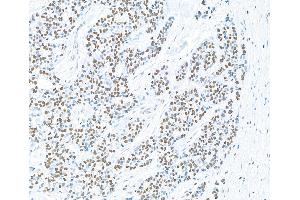 Immunohistochemistry (IHC) image for anti-Poly (ADP-Ribose) Polymerase 1 (PARP1) (AA 750-800) antibody (ABIN7449531) (Recombinant PARP1 anticorps  (AA 750-800))