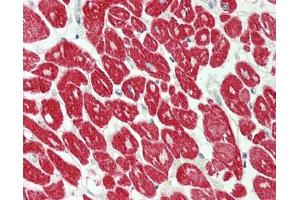 Human Heart: Formalin-Fixed, Paraffin-Embedded (FFPE)