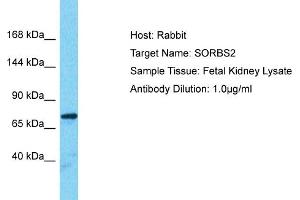 Host: Rabbit Target Name: SORBS2 Sample Type: Fetal Kidney lysates Antibody Dilution: 1. (Sorbs2 anticorps  (Middle Region))