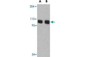 Western blot analysis of AOF2 in P815 cell lysate with AOF2 polyclonal antibody  at (A) 1 and (B) 2 ug/mL . (LSD1 anticorps  (N-Term))
