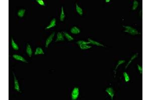 Immunofluorescent analysis of Hela cells using ABIN7170500 at dilution of 1:100 and Alexa Fluor 488-congugated AffiniPure Goat Anti-Rabbit IgG(H+L)