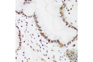 Immunohistochemistry of paraffin-embedded human gastric using PCNA antibody (ABIN1874056) at dilution of 1:200 (40x lens). (PCNA anticorps)