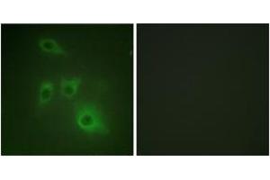 Immunofluorescence analysis of HuvEc cells, using HSP90B (Ab-226) Antibody. (HSP90AB1 anticorps  (AA 201-250))