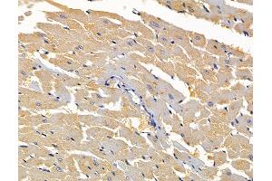 ABIN7095077 and ABIN7099133 at 1/100 staining rat heart tissue by IHC-P.