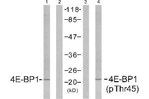 Western blot analysis of extracts from MDA435 cells untreated or treated with EGF (200nm, 5mins), using 4E-BP1 (Ab-45) antibody (Linand 2) and 4E-BP1 (phospho-Thr45) antibody (Line 3 and 4). (eIF4EBP1 anticorps  (pThr45))