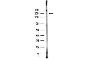 Western blot analysis of lysates from K562 cells(UV,30 min treatment), using Phospho-c-Kit (Tyr703) Antibody at 1/1000 dilution.