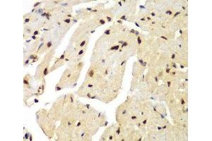 Immunohistochemistry of paraffin-embedded Mouse heart using LIG3 Polyclonal Antibody at dilution of 1:100 (40x lens).