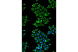 Immunofluorescence analysis of HeLa cells using CTNS antibody (ABIN5974151).