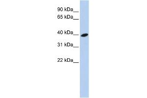 WB Suggested Anti-ARL13B Antibody Titration: 0. (ARL13B anticorps  (Middle Region))