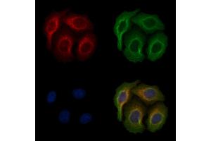 ABIN6256612 and ABIN6267176 staining heat-shock treated Hela cells by IF/ICC.