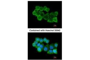 ICC/IF Image Immunofluorescence analysis of methanol-fixed A431, using alpha SNAP, antibody at 1:200 dilution.