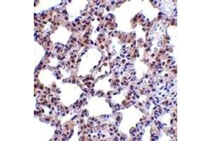 Immunohistochemistry (IHC) image for anti-Eukaryotic Translation Initiation Factor 2-alpha Kinase 2 (EIF2AK2) (N-Term) antibody (ABIN1031517) (EIF2AK2 anticorps  (N-Term))