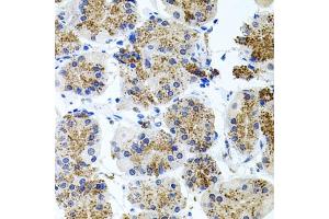 Immunohistochemistry of paraffin-embedded human stomach using Somatostatin Receptor 2 (SSTR2) antibody (ABIN3017442, ABIN3017443, ABIN3017444 and ABIN6220093) at dilution of 1:100 (40x lens).