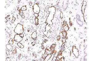 Formalin-fixed, paraffin-embedded human Kidney Transplant stained with Complement 4d Mouse Monoclonal Antibody (C4D204).
