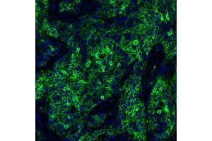 Immunofluorescence (IF) image for anti-CD274 (PD-L1) (C-Term) antibody (ABIN7454042) (Recombinant PD-L1 anticorps  (C-Term))