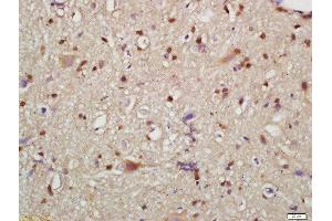 Formalin-fixed and paraffin embedded mouse brain labeled with Rabbit Anti-HMGCR(Ser872) Polyclonal Antibody, Unconjugated  at 1:200 followed by conjugation to the secondary antibody and DAB staining (HMGCR anticorps  (pSer872))