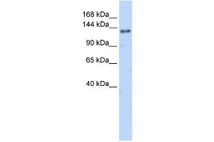 WB Suggested Anti-EIF4G2 Antibody Titration:  0. (EIF4G2 anticorps  (N-Term))
