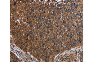 Immunohistochemistry of Human brain  using FCGR3A Polyclonal Antibody at dilution of 1:60 (FCGR3A anticorps)