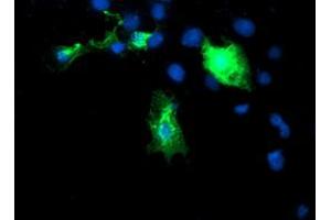 Image no. 3 for anti-DIX Domain Containing 1 (DIXDC1) antibody (ABIN1497840)