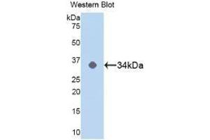 Detection of Recombinant MAPK14, Human using Polyclonal Antibody to Mitogen Activated Protein Kinase 14 (MAPK14) (MAPK14 anticorps  (AA 19-279))