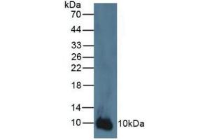 Western blot analysis of Human A431 Cells. (S100A2 anticorps  (AA 2-98))