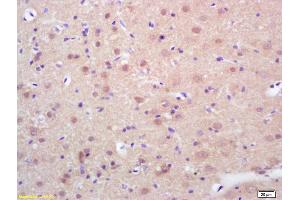 Formalin-fixed and paraffin embedded rat brain labeled with Rabbit Anti phospho-HSF1(Ser326) Polyclonal Antibody, Unconjugated (ABIN703466) at 1:200 followed by conjugation to the secondary antibody and DAB staining (HSF1 anticorps  (pSer326))