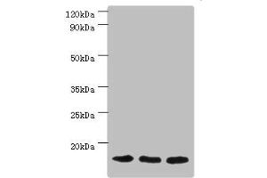 Western blot All lanes: Mitochondrial import receptor subunit TOM20 homolog antibody at 3 μg/mL Lane 1: Mouse brain tissue Lane 2: Hela whole cell lysate Lane 3: Mouse liver tissue Secondary Goat polyclonal to rabbit IgG at 1/10000 dilution Predicted band size: 16 kDa Observed band size: 16 kDa (TOMM2 (AA 20-145) anticorps)