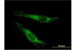 Immunofluorescence of monoclonal antibody to LSS on HeLa cell. (LSS anticorps  (AA 633-732))