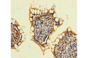 Immunohistochemistry of paraffin-embedded human small intestine tissue using ABIN7167939 at dilution of 1:100