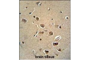 RAT SERPH Monoclonal Antibody (Center) (ABIN658998 and ABIN2838038) immunohistochemistry analysis in formalin fixed and paraffin embedded human brain tissue followed by peroxidase conjμgation of the secondary antibody and DAB staining. (SERPINH1 anticorps  (AA 222-251))