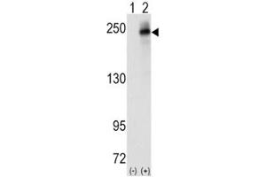 Western blot analysis of ALK antibody and 293 cell lysate (2 ug/lane) either nontransfected (Lane 1) or transiently transfected with the human gene (2). (ALK anticorps  (AA 636-666))