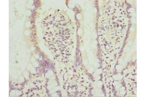 Immunohistochemistry of paraffin-embedded human small intestine tissue using ABIN7142022 at dilution of 1:100