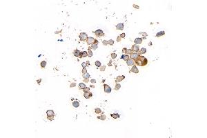 Immunocytochemistry (ICC) image for anti-CD226 (CD226) (AA 19-229) antibody (ABIN7455092)