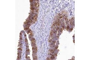 Immunohistochemical staining of human fallopian tube with LRRC34 polyclonal antibody  shows strong cytoplasmic and membrane positivity in glandular cells. (LRRC34 anticorps)