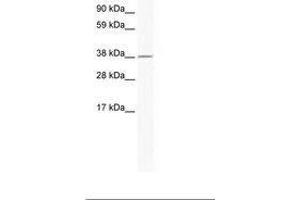 Image no. 1 for anti-Ring Finger Protein 130 (RNF130) (AA 44-93) antibody (ABIN202476) (RNF130 anticorps  (AA 44-93))