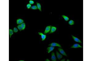 Immunofluorescent analysis of PC-3 cells using ABIN7156641 at dilution of 1:100 and Alexa Fluor 488-congugated AffiniPure Goat Anti-Rabbit IgG(H+L) (MX1 anticorps  (AA 7-172))
