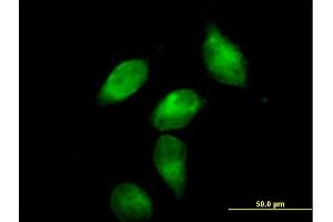 Immunofluorescence of purified MaxPab antibody to SERPINA3 on HeLa cell. (SERPINA3 anticorps  (AA 1-423))