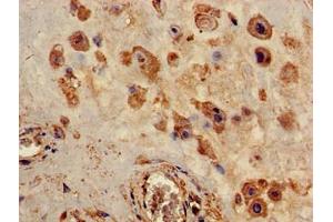 Immunohistochemistry of paraffin-embedded human placenta tissue using ABIN7162445 at dilution of 1:100 (P2RX4 anticorps  (AA 91-176))