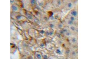 Used in DAB staining on fromalin fixed paraffin-embedded Liver tissue (Integrin alpha 1 anticorps  (AA 125-366))
