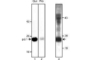 Western Blotting (WB) image for anti-Cyclin-Dependent Kinase Inhibitor 1B (p27, Kip1) (CDKN1B) antibody (ABIN967391)