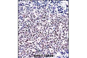 NFATC1 Antibody (C-term) ((ABIN657821 and ABIN2846788))immunohistochemistry analysis in formalin fixed and paraffin embedded human tonsil tissue followed by peroxidase conjugation of the secondary antibody and DAB staining.