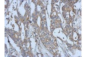 Image no. 1 for anti-EPH Receptor A3 (EPHA3) (AA 38-375) antibody (ABIN1498036)