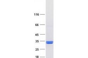 Validation with Western Blot