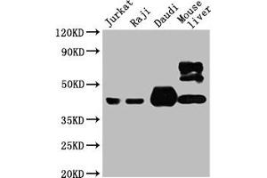 Western Blot Positive WB detected in: Jurkat whole cell lysate, Raji whole cell lysate, Daudi whole cell lysate, Mouse liver tissue All lanes: CD48 antibody at 1:4000 Secondary Goat polyclonal to mouse IgG at 1/50000 dilution Predicted band size: 28, 20KDa Observed band size: 43 KDa Exposure time:5 min