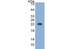 WB of Protein Standard: different control antibodies against Highly purified E. (CYFRA21.1 Kit CLIA)