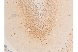 ABIN6267234 at 1/100 staining mouse brain tissue sections by IHC-P.