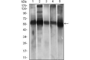 Western blot analysis using ALDH2 antibody against HEK293 (1) and ALDH2 (AA: 317-517) -hIgGFc transfected HEK293 (2) cell lysate.