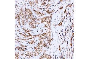 IHC analysis of Symplekin/SYMPK using anti-Symplekin/SYMPK antibody (ABIN7601558). (Symplekin anticorps  (AA 384-1092))